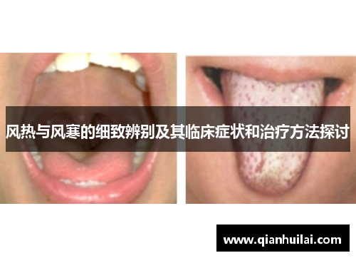 风热与风寒的细致辨别及其临床症状和治疗方法探讨